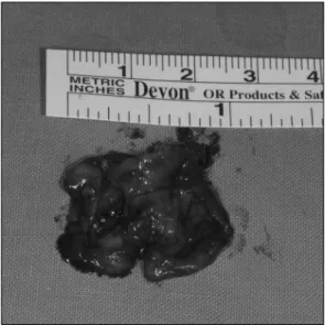 Fig. 5. Second preoperative photograph. Wax-up for making resin block using rapid prototyping model.