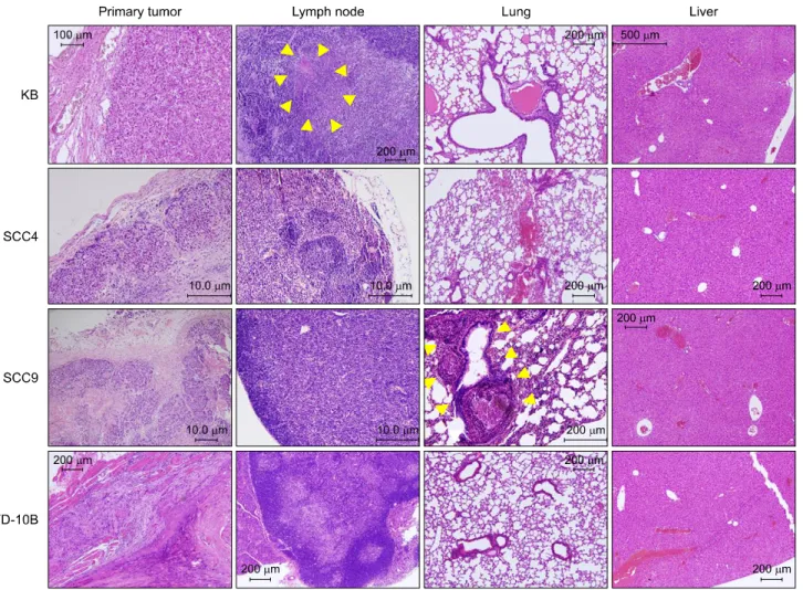 Fig. 2. Histological features of recapitulating orthotopic tumors and cervical lymph nodes, lung, and liver (H&amp;E)