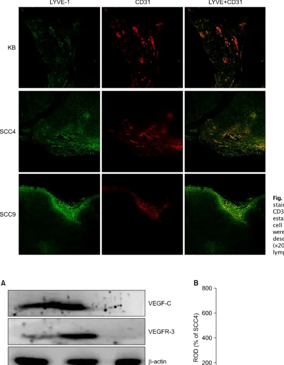 Fig. 7. Double immunofluorescence staining for LYVE-1 (green) and  CD31 (red) of submandibular tumors established with four different OSCC cell lines