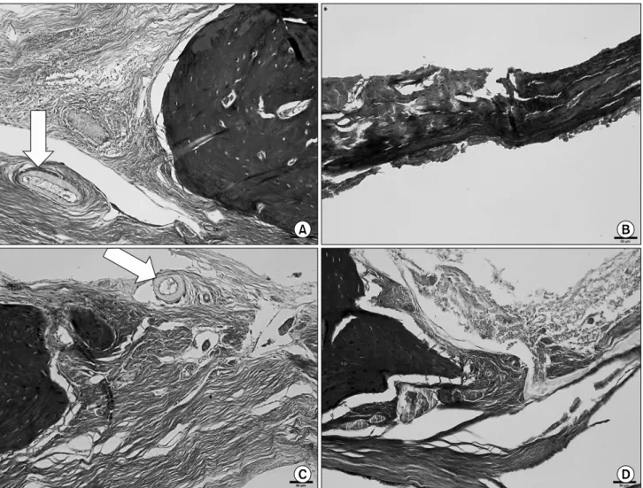 Fig. 1. Hydroxyapatite/silk fibroin particle was grafted into the  center of parietal bone.