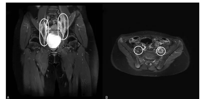 Figure 1. Magnetic resonance imaging scans. (A) Coronal image and (B) axial image.