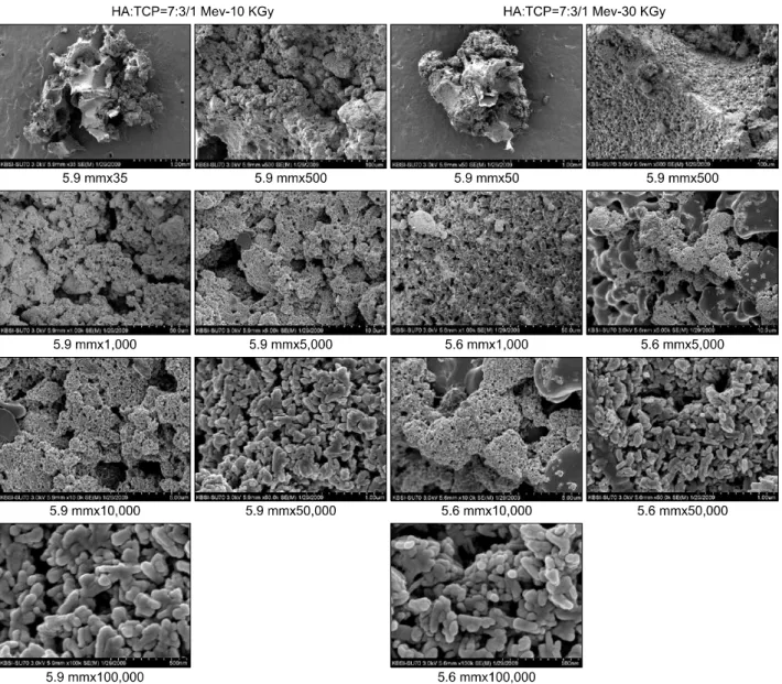 Fig. 9. Mixed particulations of HA with small TCP particles in the SEM findings of 7:3 ratio's of HA and TCP under the 1 MeV∼1  KGy and 1 MeV∼30 KGy electron beam irradiations, ×35, ×500, ×1,000, ×5,000, ×10,000, ×50,000, and ×100,000 magnifications, indiv