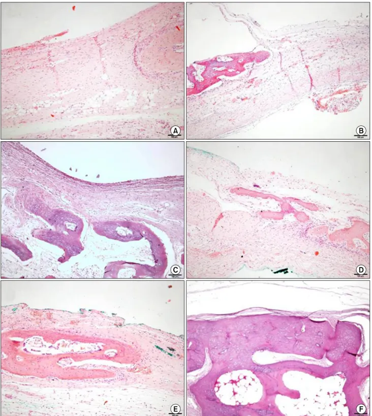 Fig. 3. Histological view (original magnification ×100, H&amp;E stain). (A) The unfilled control at 4 weeks postoperatively