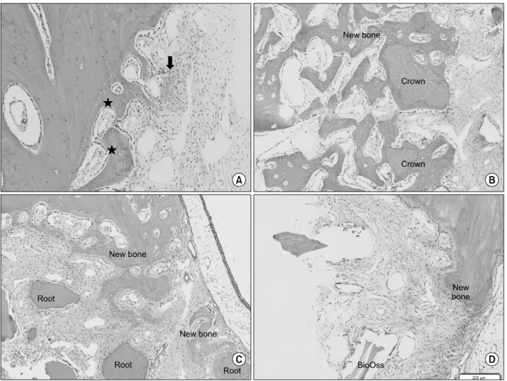 Fig. 11. (A) Histologic finding 2 weeks of group I. New bone formation adjacent preexisting bone is observed