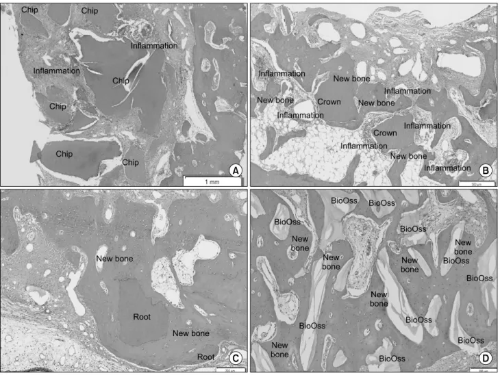 Fig. 15. (A) Histologic finding 8 weeks of group I. New bone formation around the chips is hindered by inflammatory cells (H&amp;E,