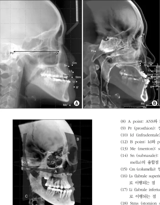 Fig. 1. (A) Horizontal reference line and soft tissue landmarks in lateral cephalogram