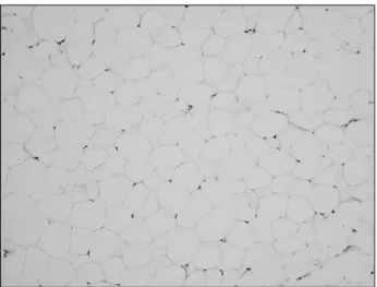 Fig. 6. Microscopic view, mature adipose cells (H&amp;E staining, 