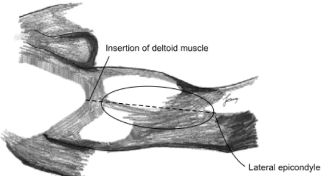 Fig. 4. Schematic drawing of basic design for the lateral upper 