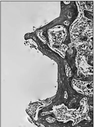 Fig. 13. Masson's trichrome stain of non-low-intensity pulsed ul- ul-trasound group at 1 week (×100).