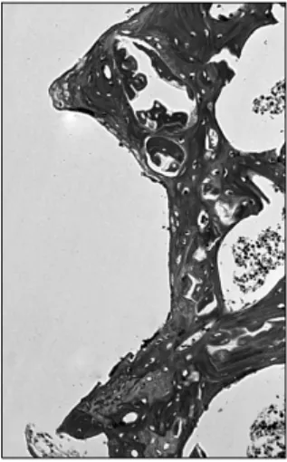Fig. 17. Masson's trichrome stain of non-low-intensity pulsed ul-