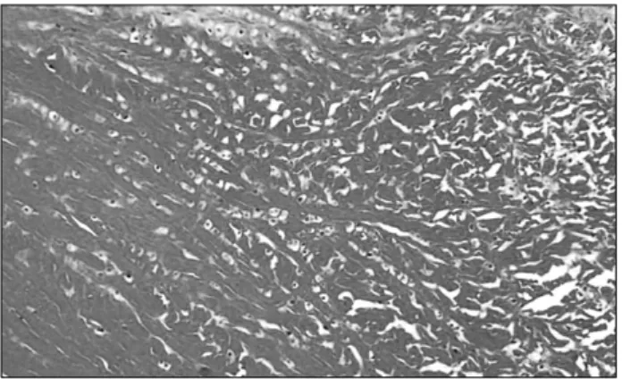 Fig. 8. Post-operative 10 days. Accoring to the transition from central area to peripheral area, the disc shows increasing  haphazard arrangement (van Gieson, ×200).