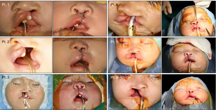 Fig. 3. Pre-operative and post-operative photographs of each patient.