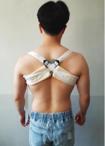 Fig.  2.  Taping  intervention  group.