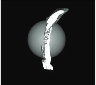 Fig. 3.  Region  of  interest.  5  mm  diameter  round  type. 