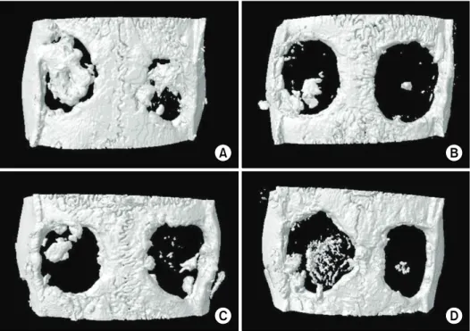Fig. 6. Micro-computed tomography rendered images. (A) SF-BMP. (B) RAW.