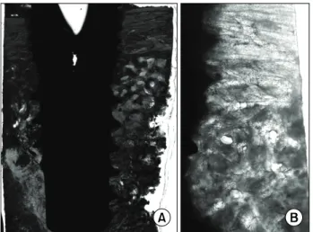 Fig. 2. (A) Low power view showed almost complete new bone  formation above the first thread level and peri-implant spaces