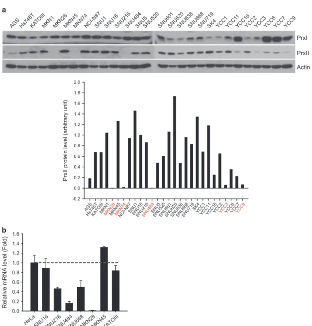 Figure 1 Endogenous PrxII expression in gastric cancer cell lines. (a) Cell lysates from 28 gastric cancer cell lines were prepared and subjected to immunoblot analysis