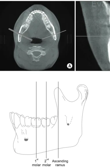 Fig. 2. Converted image by using  Ondemand program. (A) Axial image.