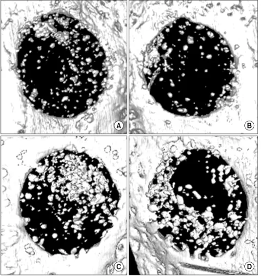 Fig. 3. Microscopic computed to- to-mography. (A) Experimental group  at 4 weeks. (B) Control group at 4  weeks