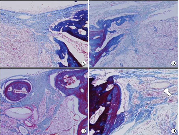 Fig. 4. Histologic section (Masson’s trichrome staining, original magnification ×100)