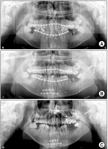 Fig. 3. Comparison of post-operative complications.