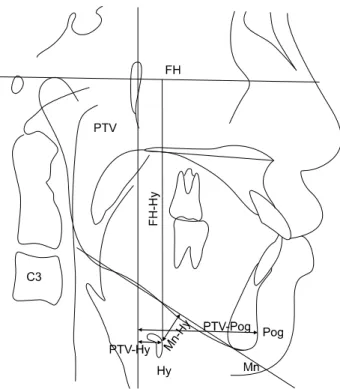 Fig. 1. The measurement of hyoid bone position.서    론현재  하악골  및  상악골의  골격적인  기형뿐  아니라  심미적인 목적을  위한  다양한  악교정수술이  시행되고  있으며  다양한  악교정수술법이  개발되어서  거의  모든  안면부  기형환자를  교정할  수 있게  되었다
