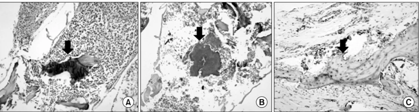 Fig. 6. Histopathologic views. (A) It showed the xenograft particle and granulation tissues in center of lesion (arrow) (H&amp;E, ×200).
