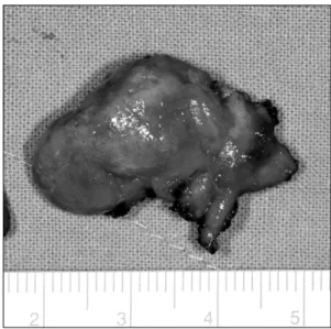 Fig. 2. Axial and coronal CBCT (cone-beam computed tomo-