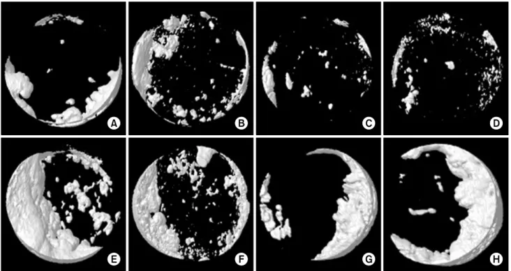 Fig. 1. Micro-CT view. The specimen from 4 weeks after grafting were A, B, C, and D. The specimen from 8 weeks after grafting were E, F, G, and H