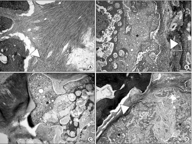 Fig. 3. Histological view at 8 weeks after grafting (A: unfilled control, B: silk only, C: silk＋substance P (10μg/ml), D: silk+substance P (100μg/ml)
