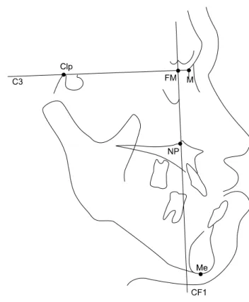 Fig. 1. McNamara's analysis.