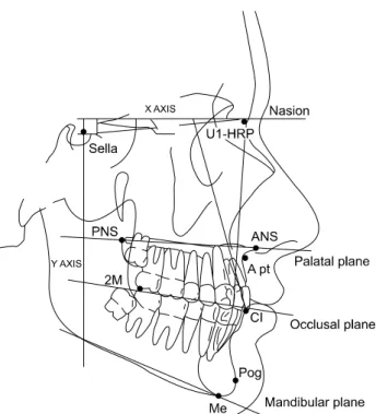 Fig. 1. Reference lines and measurement lines.