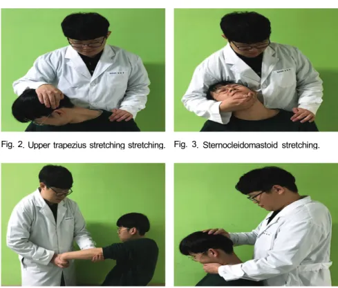 Fig. 3. Sternocleidomastoid stretching.