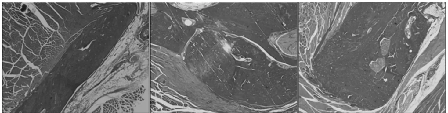 Fig. 6. Histologic observation of collaguide membrane (arrow) at 4 weeks in bone  defect model (H&amp;E stain) (Magnification A: ×40, B: ×100, C: ×400)