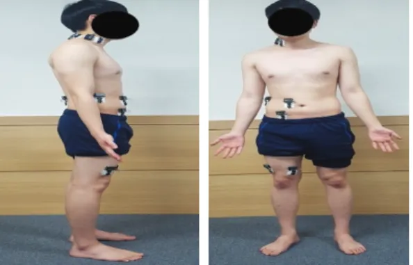 Fig. 3. Abdominal drawing- drawing-in maneuver.