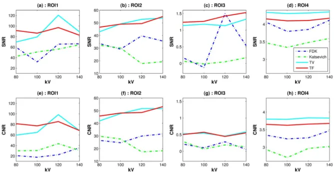 Fig 4. Image noise measures: Plots of SNRs(top row) and CNRs(bottom row) with the different reconstruction algorithms over various voltage levels