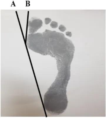 Fig. 1. Foot print.
