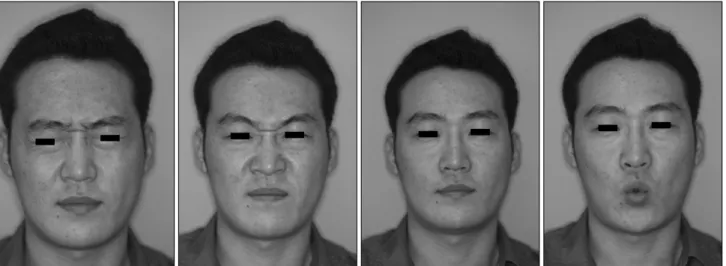 Fig. 3. Postoperative clinical photograph (post operative day 4M).