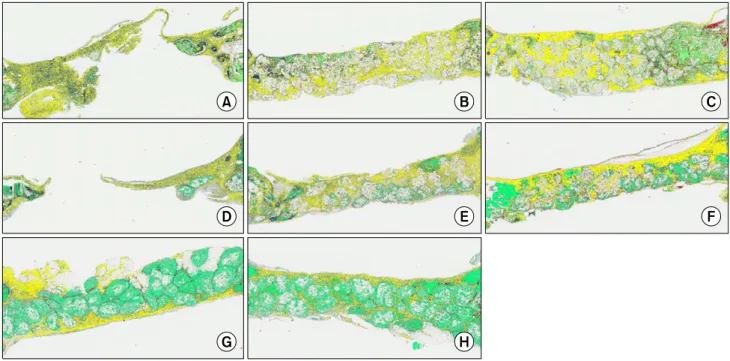 Fig. 4. Histomorphometric measurements: (green) newly formed bone marked in an interactive manner and defined as bone surface  area (BA)