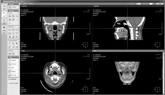 Fig. 1. Three-dimensional model re- re-construction with OnDemand3D TM program.