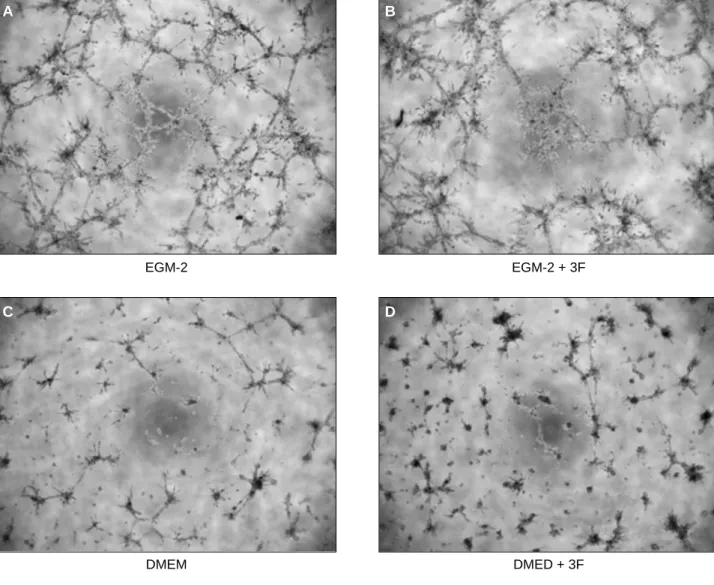 Fig. 5. Tube formation of adipose tissue-derived CD146 positive endothelial cells in DMEM, DMEM with osteogenic inductive agents, EGM-2, and EGM-2 with osteogenic inductive agents