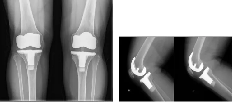 Fig. 2-A Fig. 2-B