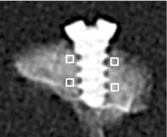Fig. 2. Example  of  X-rayed  sample  used  for  radiographic bone density measurements