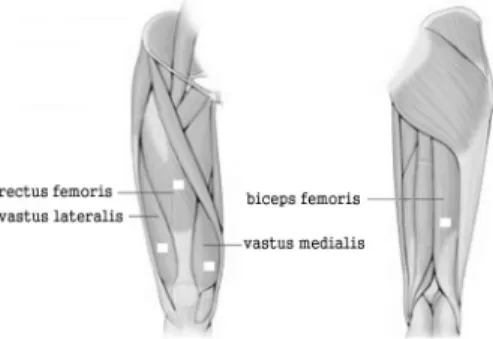 Fig. 1. The placement of surface EMG electrodes.