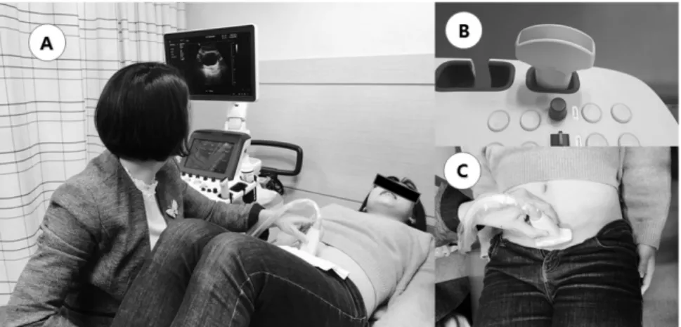 Fig. 1. Measurement of the bladder distance using real-time ultrasound imaging. 