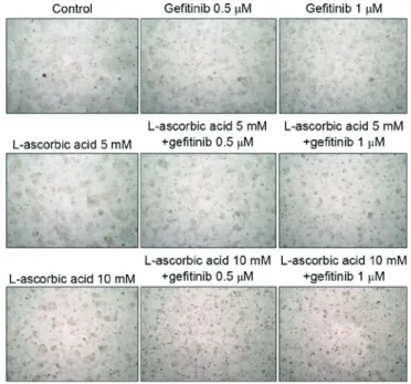 Figure 2. Microscopic images of Calu‑3 cells treated with gefitinib and/or  L‑ascorbic acid