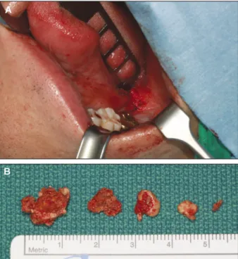 Fig. 6. Preoperative panoramic view.