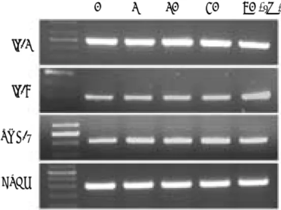 Fig. 7. RT-PCR analysis of interleukin-1, -6 and TNF-a fol- fol-lowing hydroquinone exposure