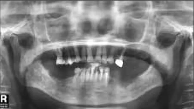 Fig. 8. Postoperative panoramic view.