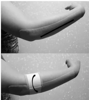 Fig. 2. Sport taping.